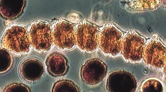 Panssarisiimaleviä mikroskoopin kautta nähtynä.